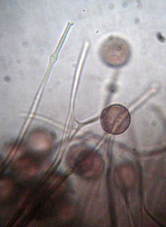 Potrebbe essere Badhamia sp?